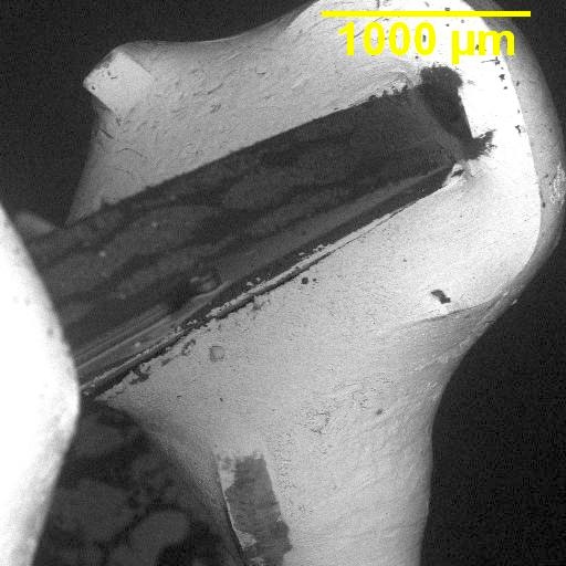 Preview image for Case 1657
