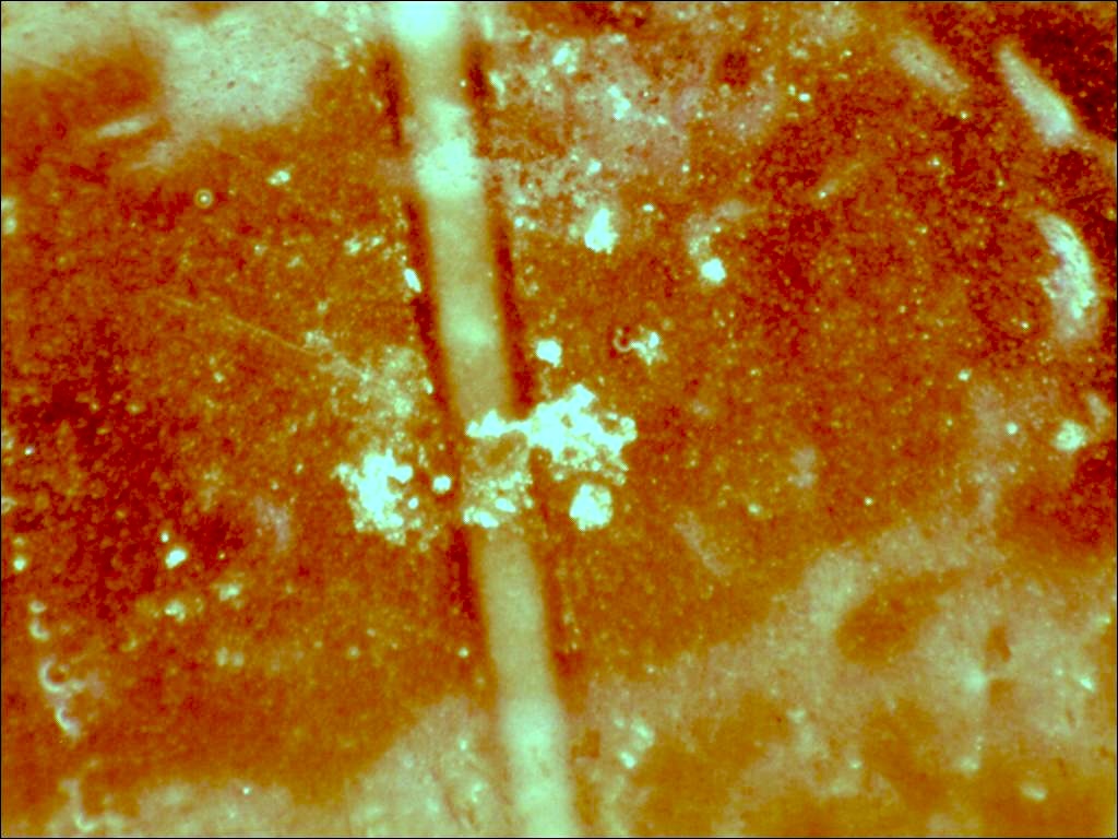 Preview image for Case 2471