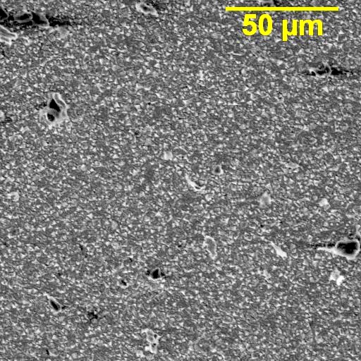 Preview image for Case 1734
